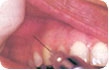 Conheça a ação da anestesia odontológica no corpo humano