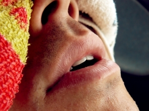 Microchip no céu da boca pode reduzir ronco em paciente com apneia leve
