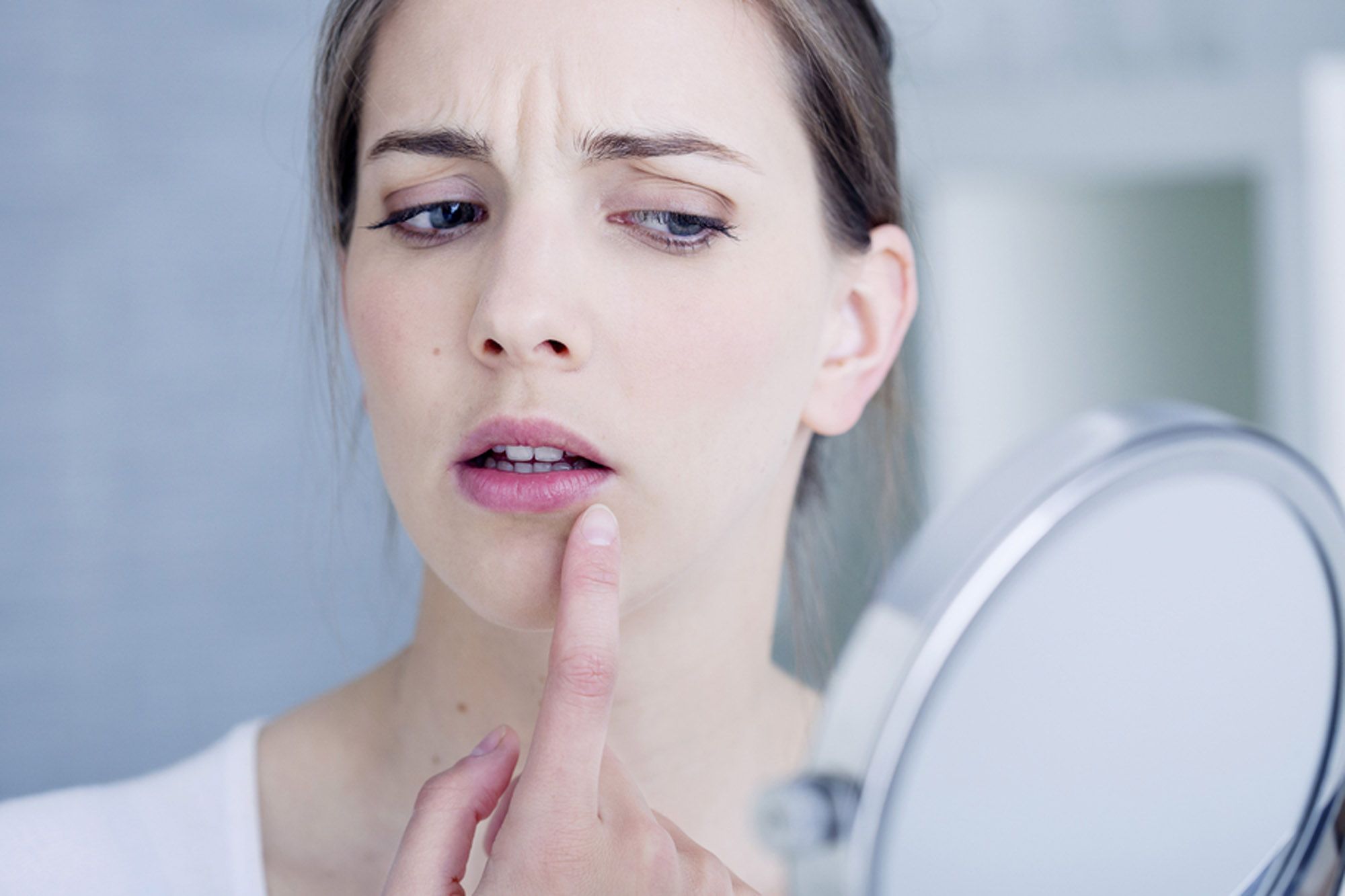 HERPES BUCAL X ANSIEDADE: O que é e como prevenir?