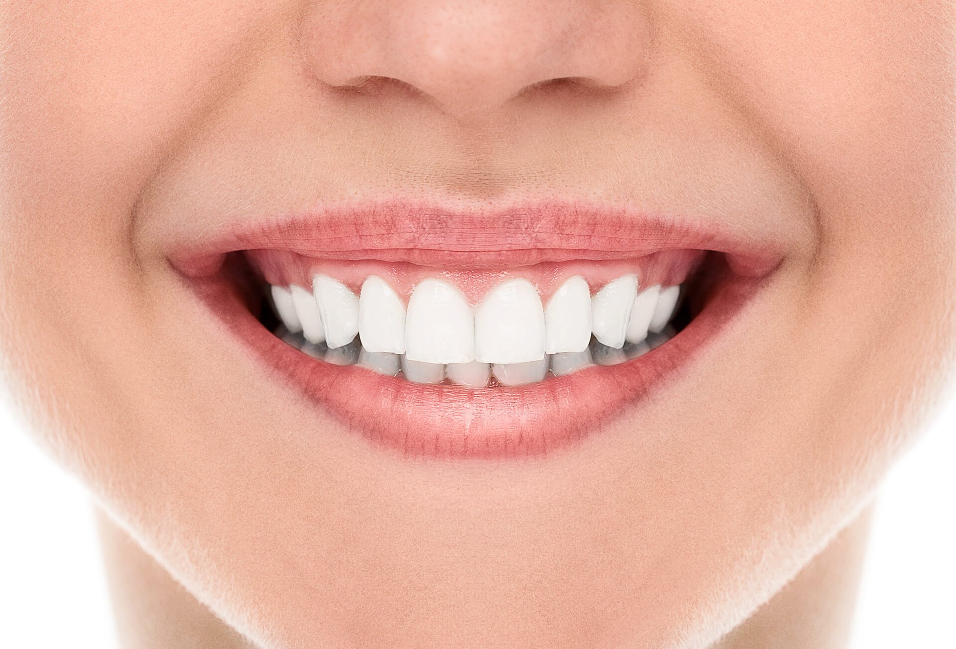 É PRECISO DESGASTAR OS DENTES PARA COLOCAR FACETA DE PORCELANA?
