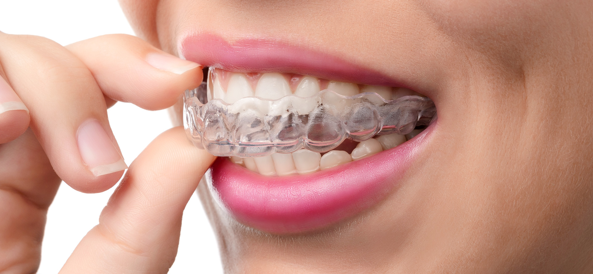 Placa de bruxismo feita de acrílico é melhor do que a de silicone?