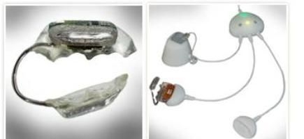 Aparelho auditivo dental aprovado na Europa