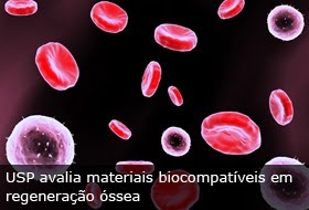 Osso produzido em laboratório?Alternativa para quem precisa de enxerto