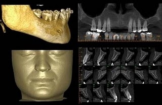 imagem 3D permite planejamento preciso e  visualização de resultados cirúrgicos