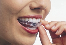 Bruxismo pode ser a causa de dores constantes de cabeça