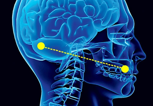 Evidências comprovam ligação entre a inflamação na gengiva e o Alzheimer
