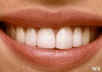 Estudo revela a fórmula do sorriso perfeito