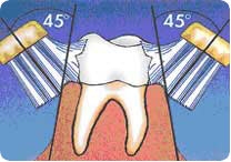 IDOSO: UMA ESCOVA PARA CADA USO