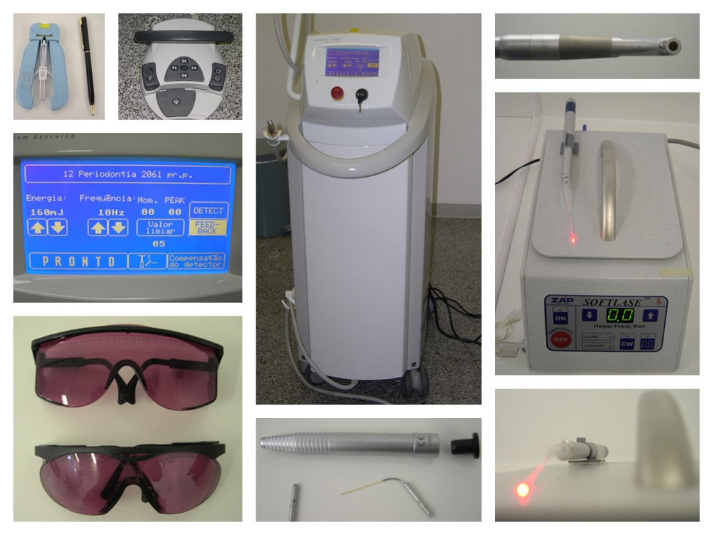 Odontologia: Laser de alta potência auxilia o tratamento de canal