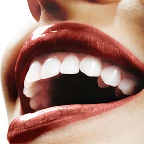 Você sabe o que é faceta laminada em porcelana?