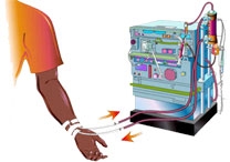 Atendimento Odontológico Diferenciado  em Pacientes Nefropatas