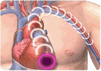 Escovar os dentes ajuda a evitar ataque cardíaco
