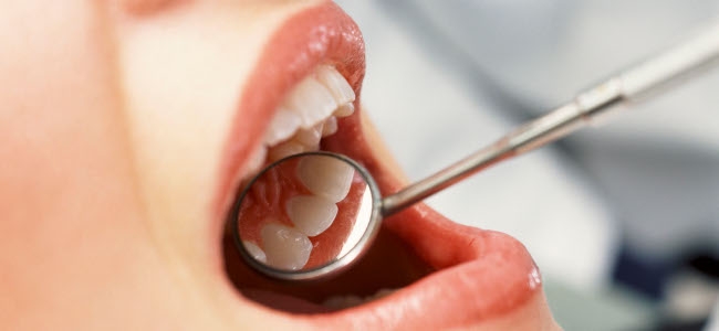 EFEITOS DA DIABETES NA OSSEOINTEGRAÇÃO DE IMPLANTES DENTÁRIOS