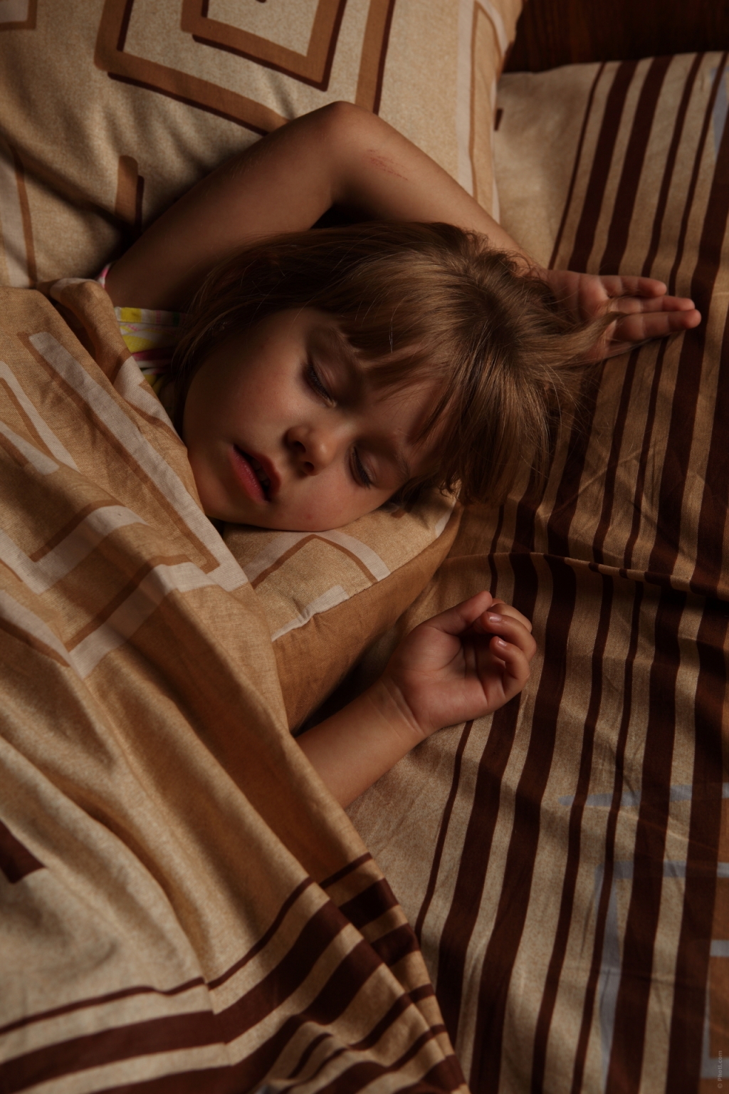 Investigação associa apneia em criança à malformação dentária