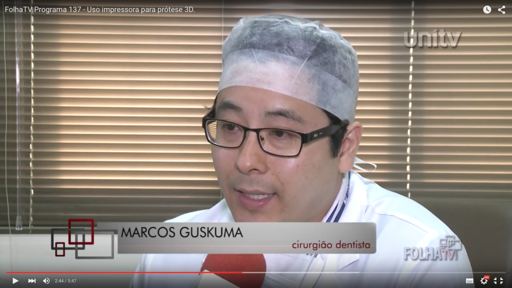 Cirurgiões utilizam tecnologia de impressão 3D em titânio para reconstrução de deformidade facial