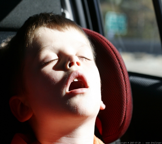 A respiração bucal e as deformidades dento-faciais